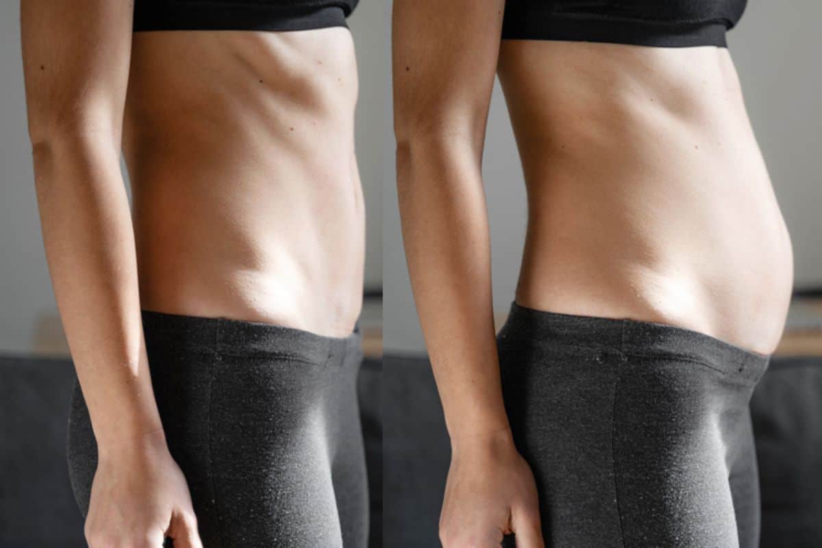 How long does diastasis recti take to improve Leighton Buzzard?