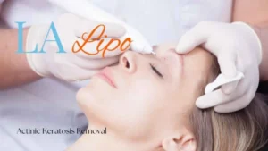 Woman receiving Actinic Keratosis Removal Treatment Leighton Buzzard