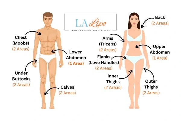 LA LIPO Cryolipolysis Areas Leighton Buzzard