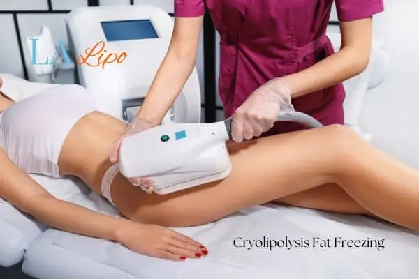 Woman receiving coolsculpting Leighton Buzzard treatment on her thighs