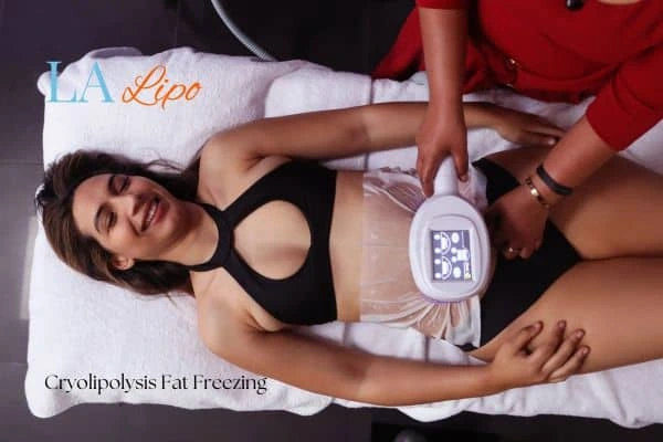 woman getting cryolipolysis Leighton Buzzard