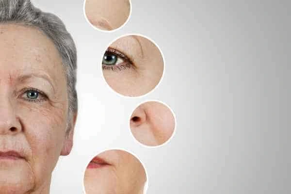 HIFU Facelift Leighton Buzzard from LA LIPO