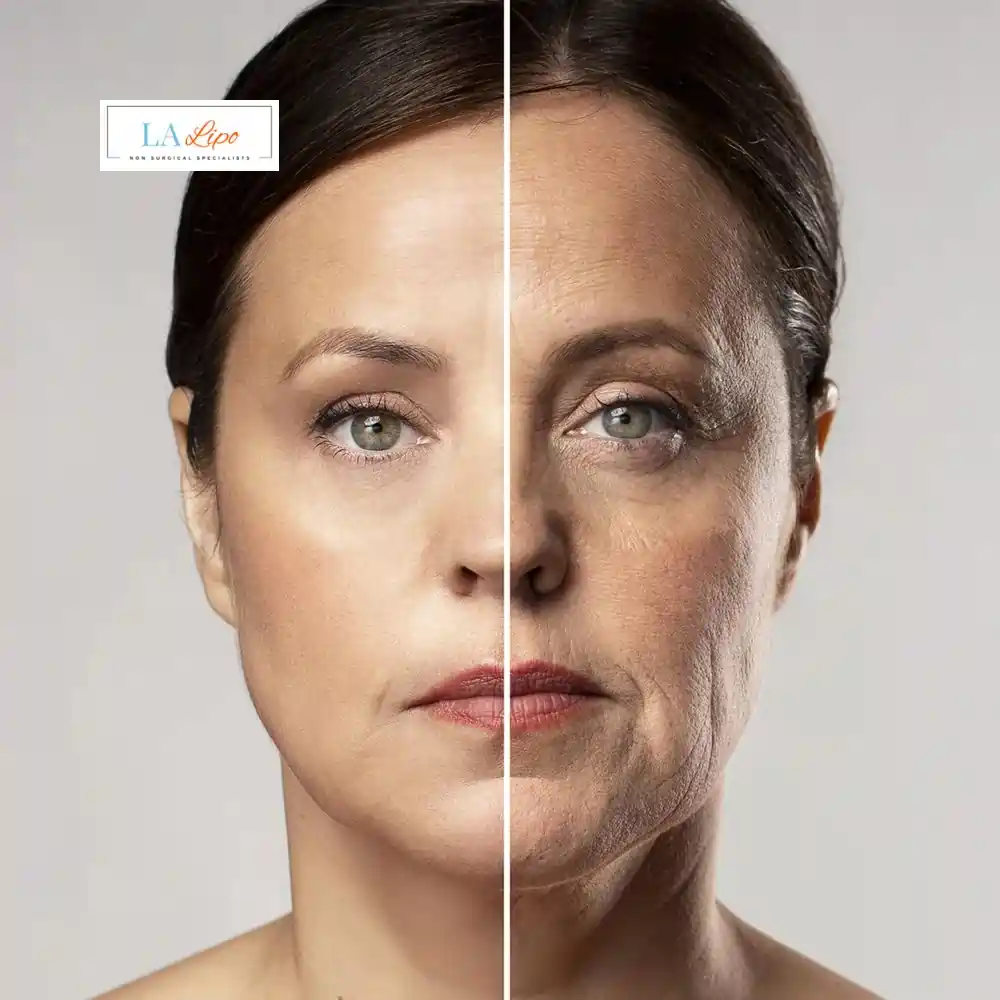 How Can You Tell If Non-Surgical Skin Tightening Is Right for You Leighton Buzzard?