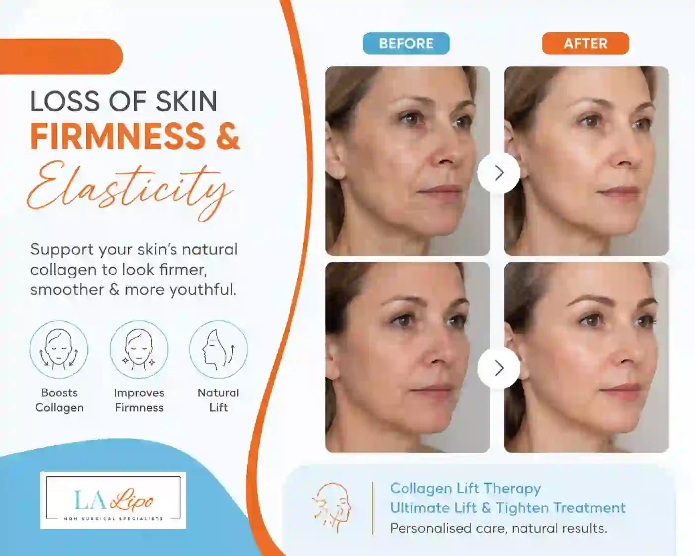 Sign #7: Loss of Skin Firmness and Elasticity Leighton Buzzard