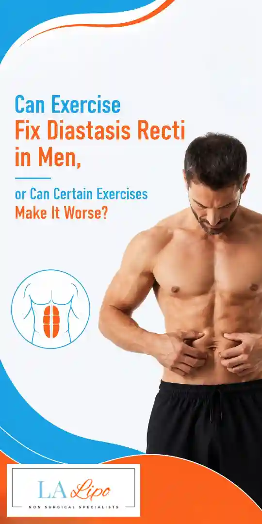 Can Exercise Fix Diastasis Recti in Men, or Can Certain Exercises Make It Worse Leighton Buzzard?