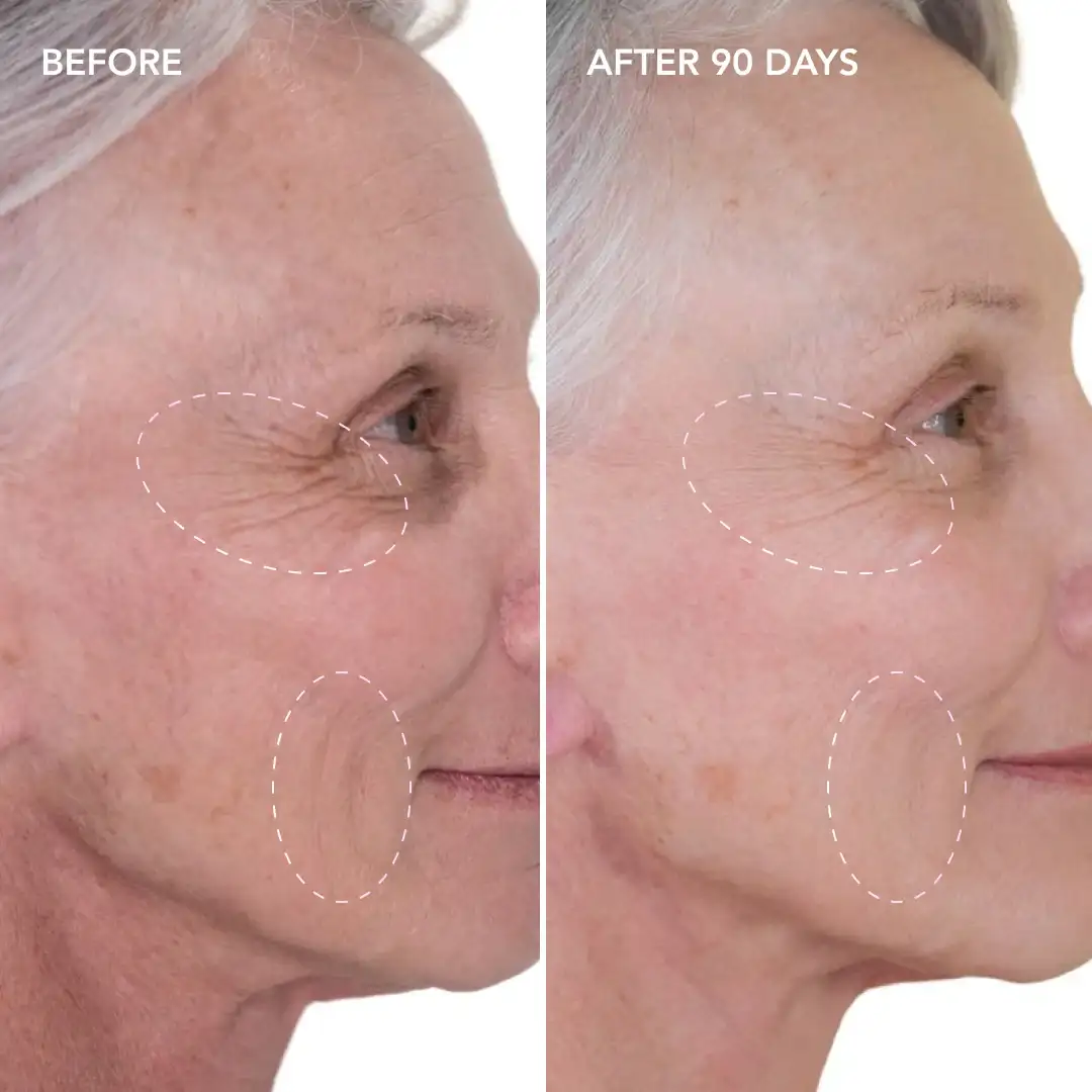 When will you see results Leighton Buzzard